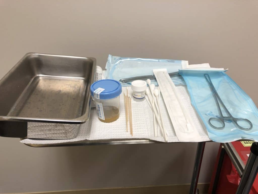 Uterine Ablation - My Experience 5 endometrial biopsy medical tools