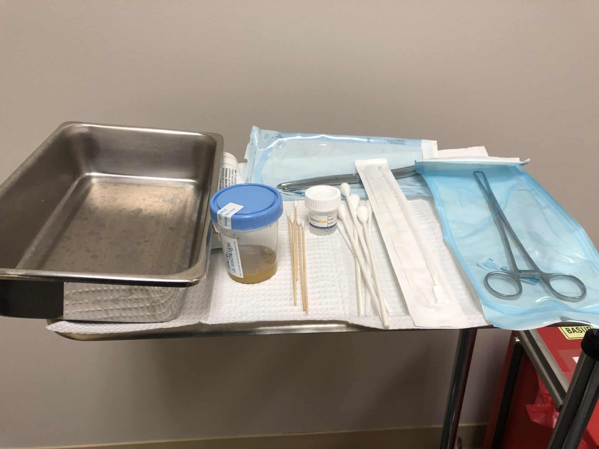 Uterine Ablation My Experience and Novasure Review