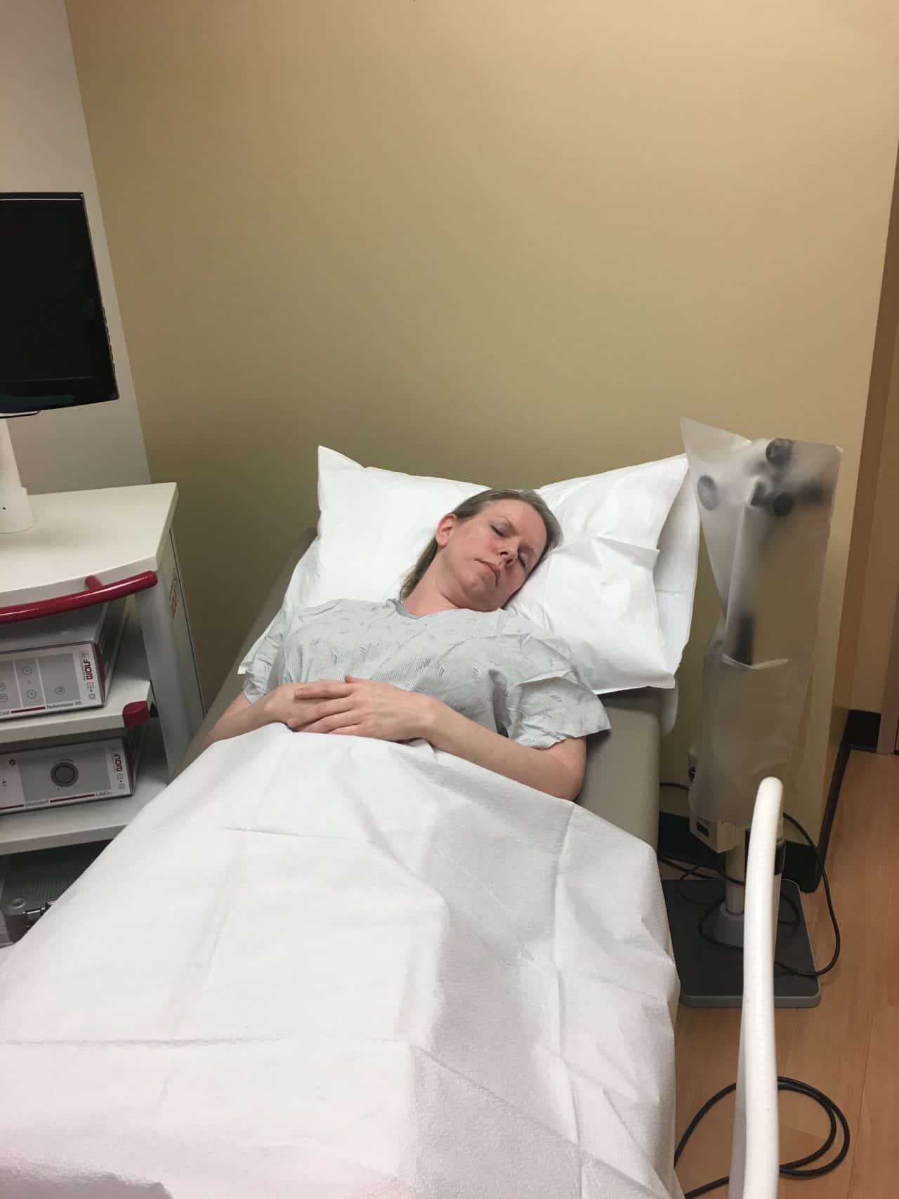 Uterine Ablation My Experience and Novasure Review